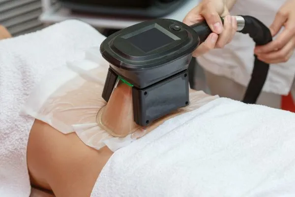 Image of person having fat freezing treatment to help weight gain Waltham Forest