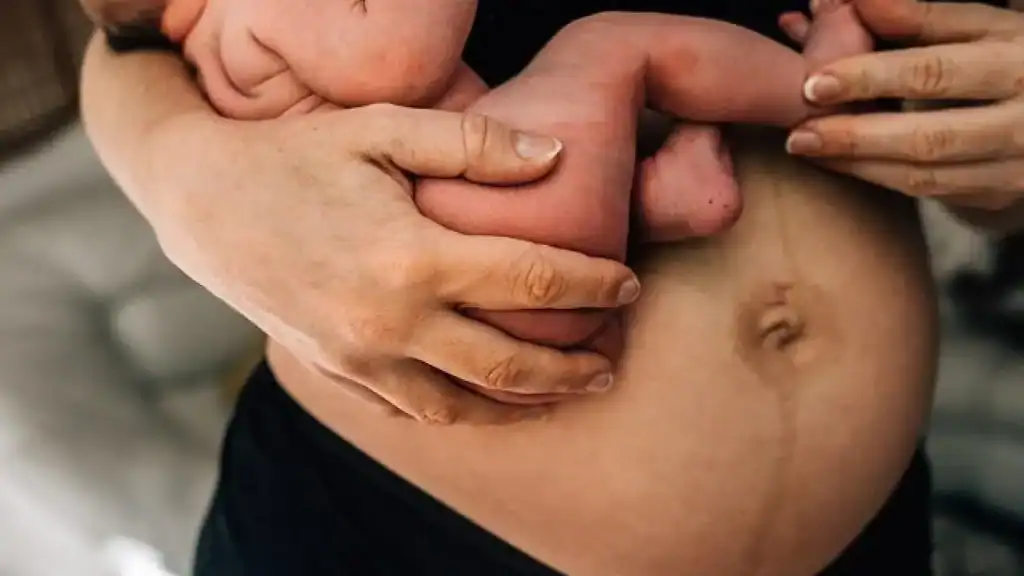 Why Is My Stomach Still Big After Pregnancy Waltham Forest?